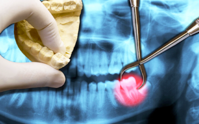 Radiologia odontoiatrica